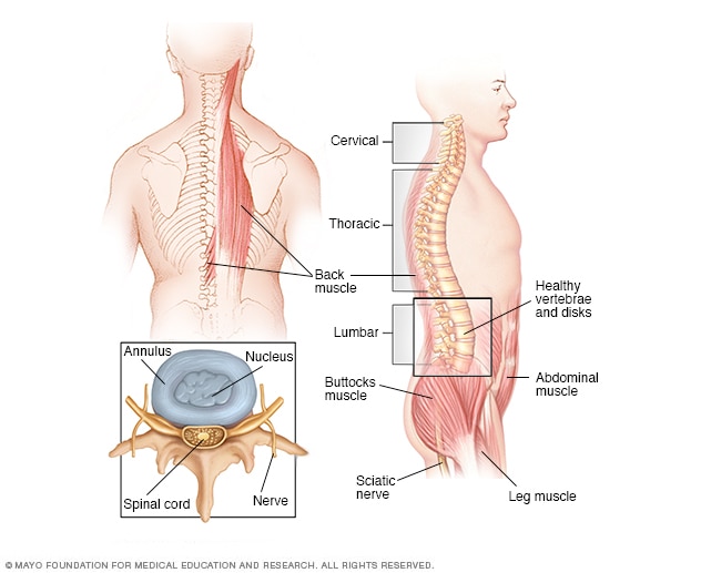 spinal-cord-tumor-symptoms-and-causes-mayo-clinic