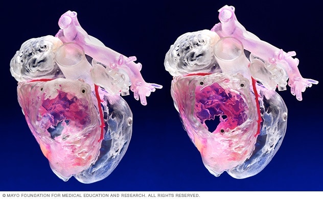 3D-printed models of the heart and related parts of the vascular system are used in medical education
