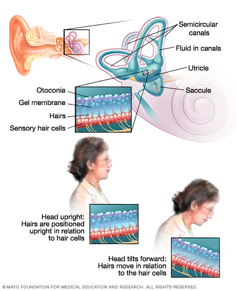 Dizziness Symptoms And Causes Mayo Clinic