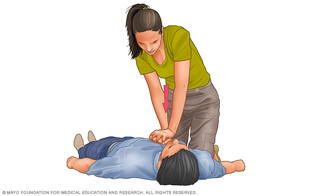 Skuespiller Siege tempo Cardiopulmonary resuscitation (CPR): First aid - Heart Saver Institute