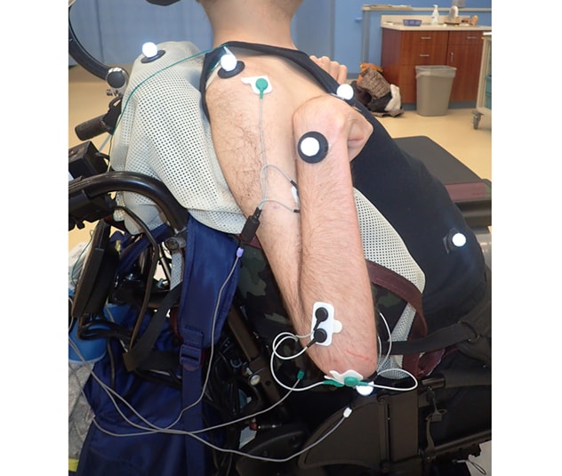 Un paciente se prepara para una electromiografía dinámica con análisis de movimiento