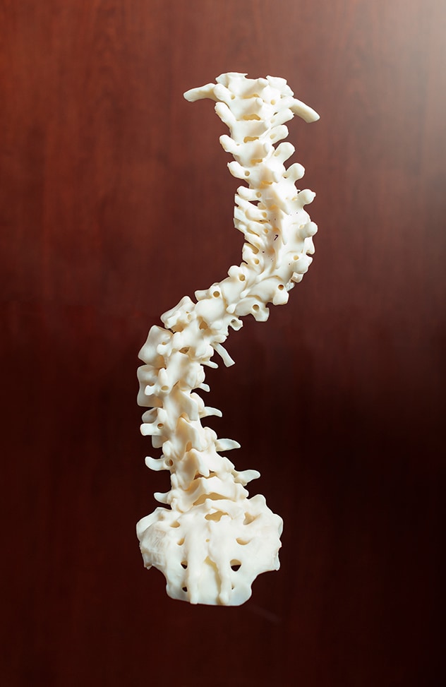 Imagen en 3D de la columna vertebral antes de la resección