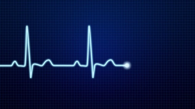 مخطط كهربية القلب