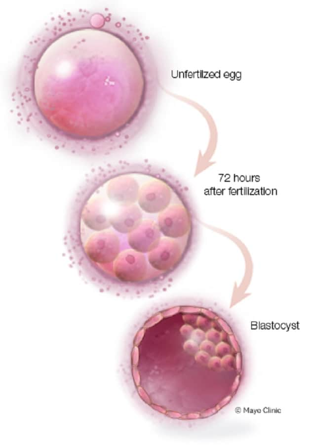 Blastocyst