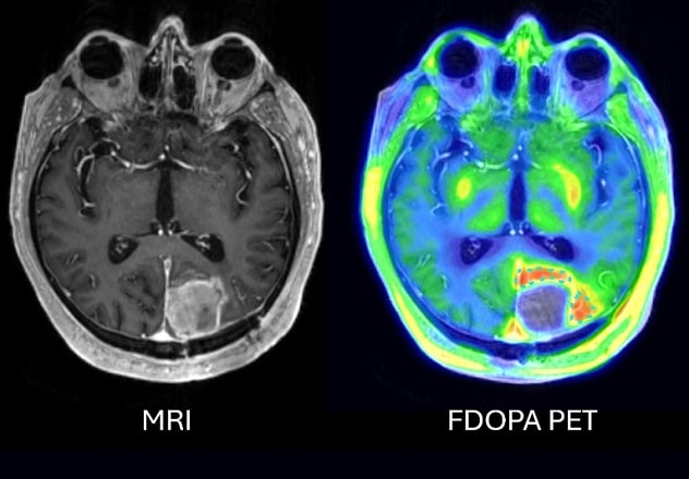 Essential tumor information