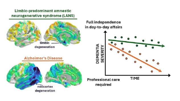 Comparing LANS and Alzheimers disease