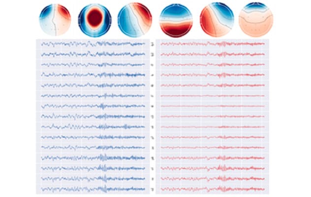 AI-Powered insights into brain activity