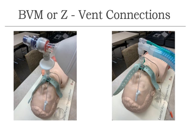 Advanced supraglottic airway device