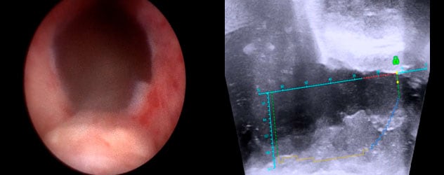 Postoperative