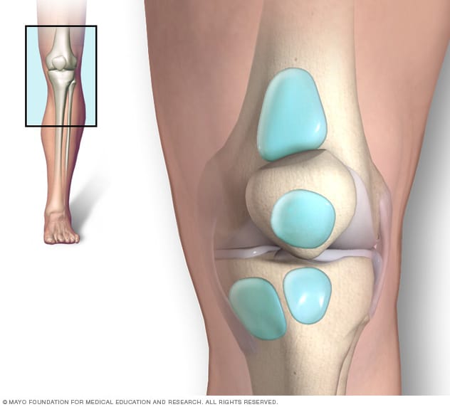 inflammation below knee cap