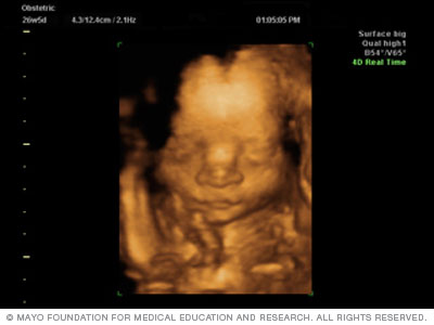3d and 4d ultrasound pictures baby face