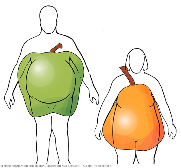 Apple and pear body shapes - Mayo Clinic