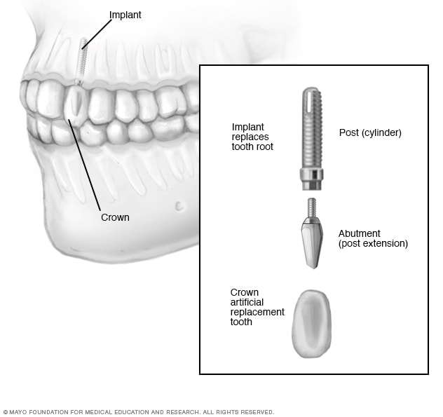 Orthodontist In Garland