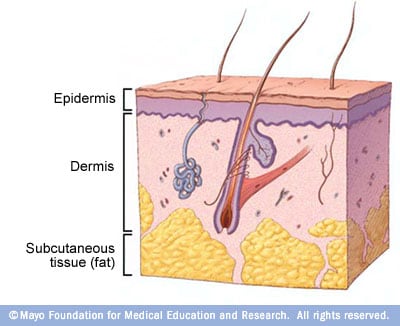 Ilustración de las capas básicas de la piel 