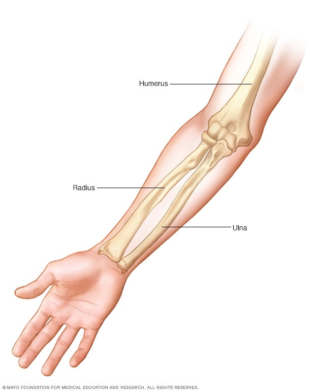 Broken arm - Symptoms and causes - Mayo Clinic
