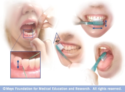 Brushing and flossing for oral health - Mayo Clinic