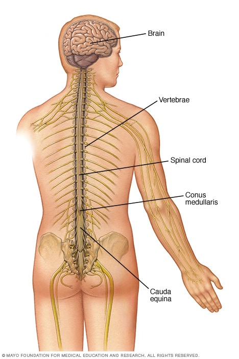 una lesion en la medula espinal puede causar paralisis
