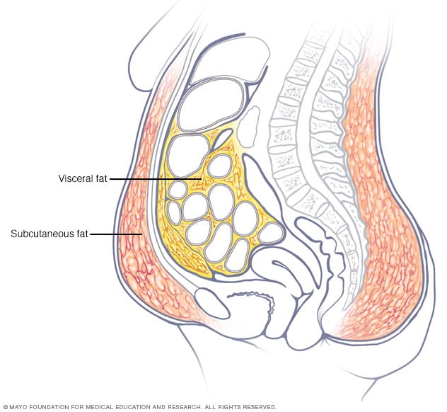 Grasa abdominal en las mujeres: cómo deshacerse de ella y cómo