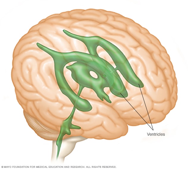 ventrículos del cerebro