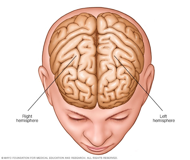 Hemisferios Cerebrales Mayo Clinic