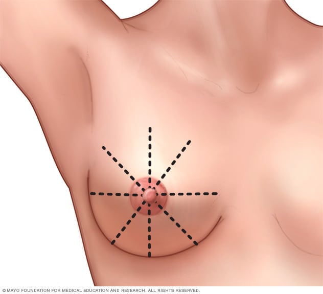 Breast self-exam for breast awareness - Mayo Clinic