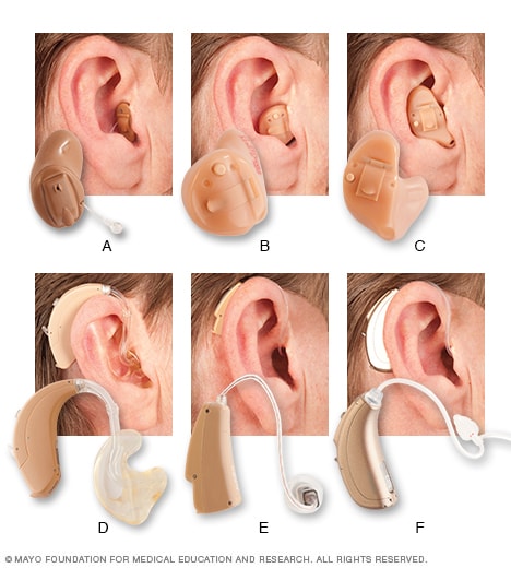 What are invisible hearing aids? - Healthy Hearing
