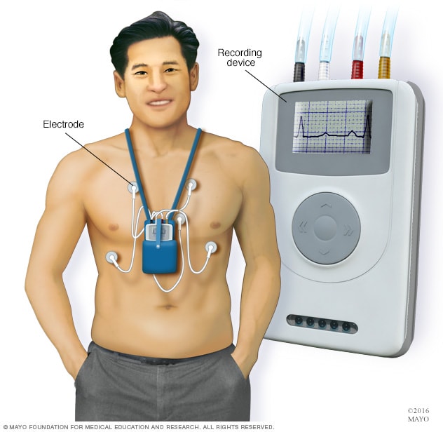 Parallel tests with ECG247 Smart Heart Sensor and Medilog AR4 Holter