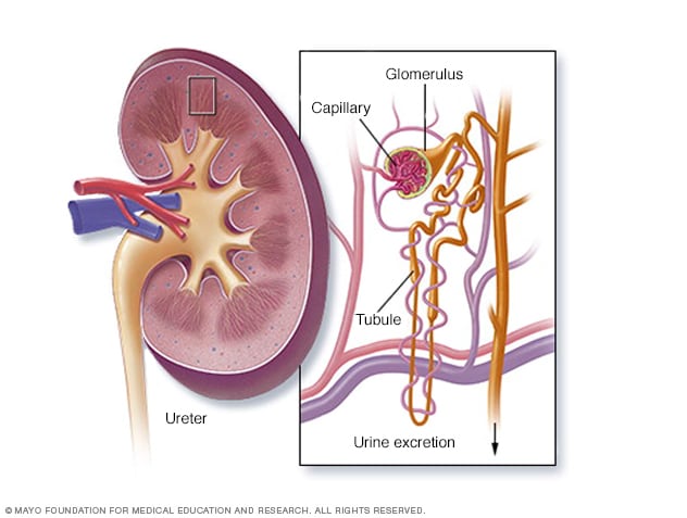 nephrotic syndrome kidney