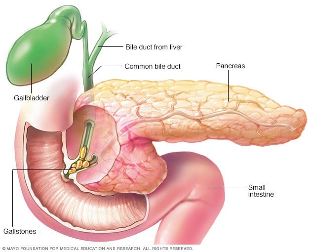Enlarged pancreas