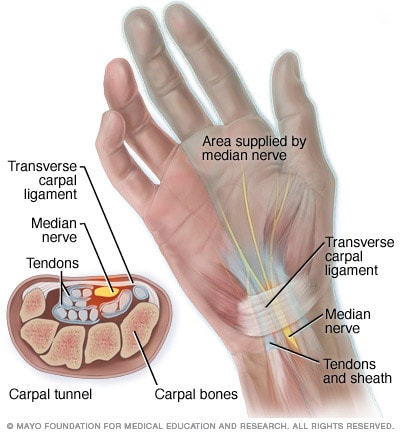 Anatomía del túnel carpiano - Mayo Clinic