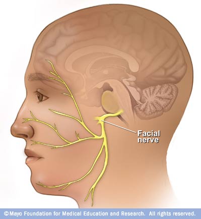 Ilustración de un nervio facial