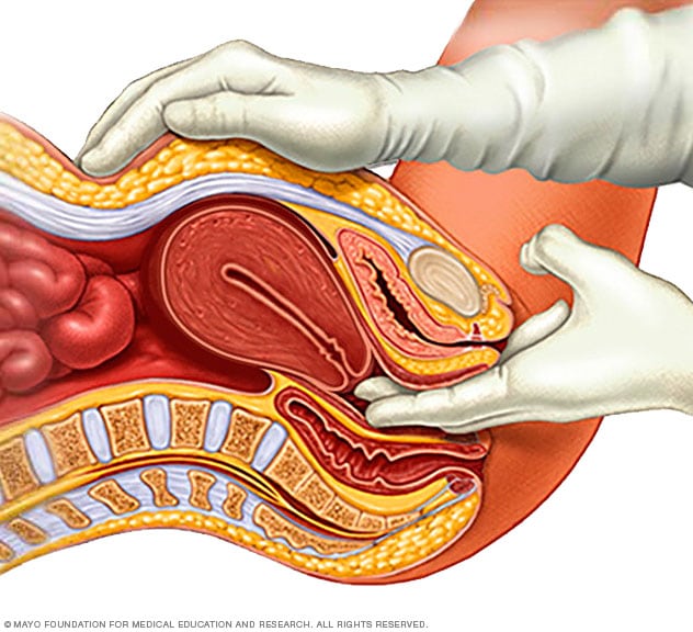 Pregnancy - Fibroid Treatment Clinic