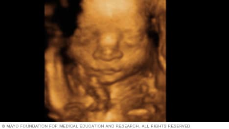 Imagen de ecografía 3D que muestra la cara de un feto