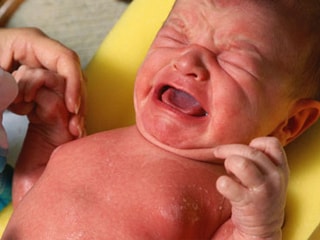 Photo of a newborn's swollen breasts