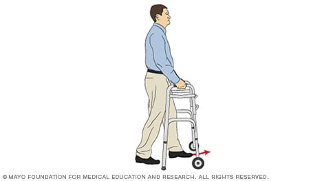 Ilustración de una persona poniendo un pie sobre un andador