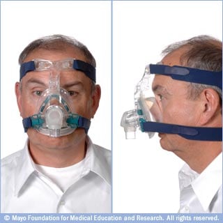 Fotografías de mascarilla nasal de presión positiva continua en la vía aérea que aspira la cara y tiene correas laterales