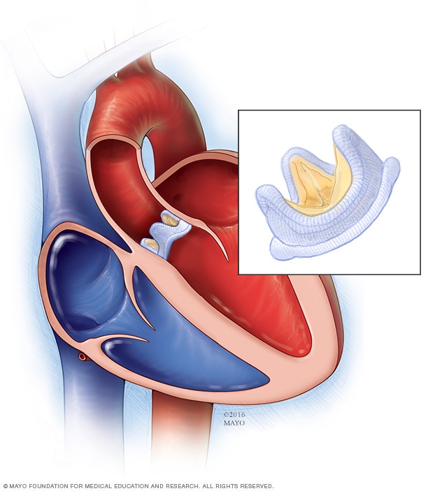 4 Heart Valves: What They Are and How They Work