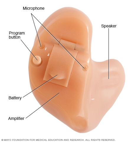 hearing aid diagram