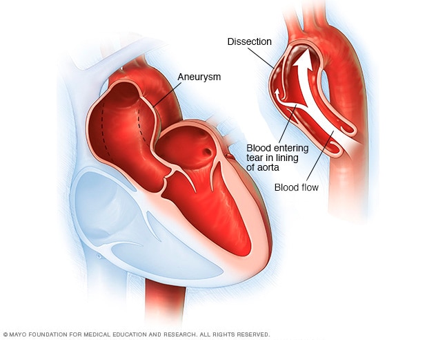 Heart Diagram Ascending Aorta