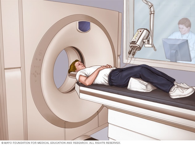 CT scan Mayo