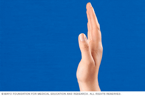 Ejercicios para artrosis de manos y dedos 