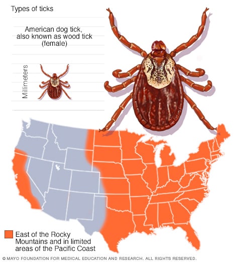 Slide Show Guide To Different Tick Species And The Diseases They Carry Mayo Clinic