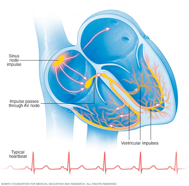 أعراض تسرع القلب البطيني وأسبابه في Mayo Clinic