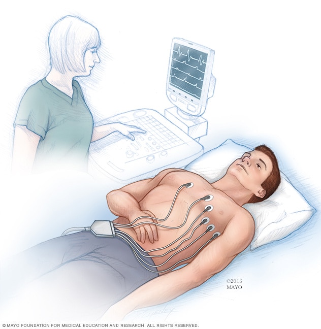 https://www.mayoclinic.org/-/media/kcms/gbs/patient-consumer/images/2016/10/11/18/07/mcdc7_electrocardiogram-8col.jpg