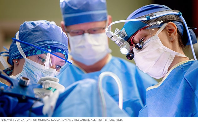 Neurocirujanos llevando a cabo una cirugía para tratar la epilepsia