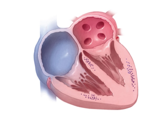 Sarcoidosis - Symptoms and causes - Mayo Clinic