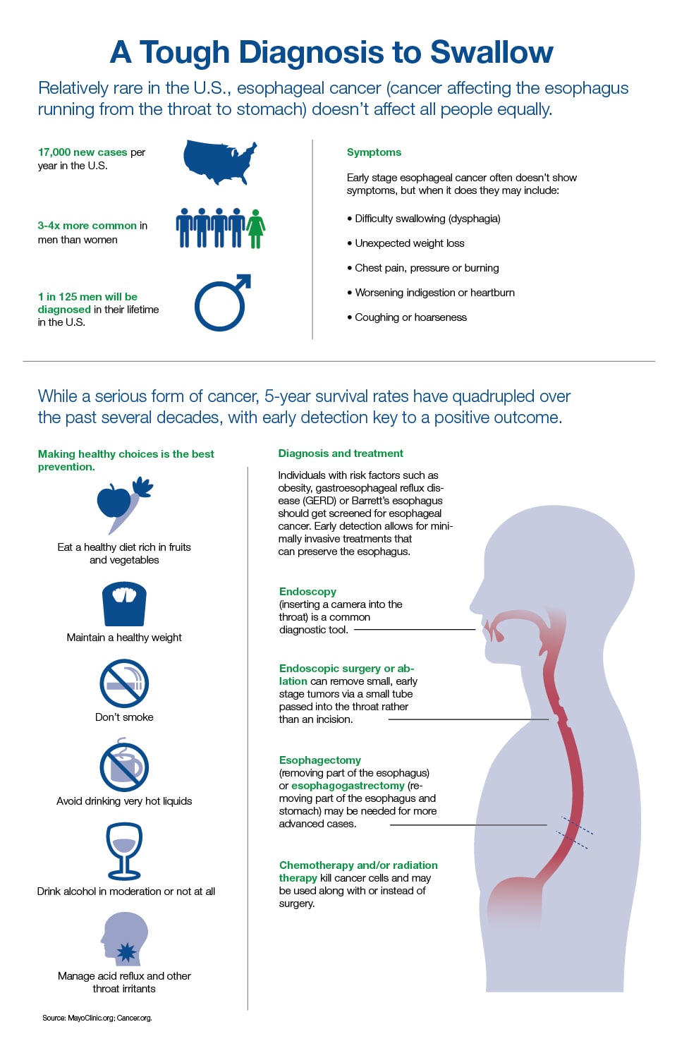 Esophagus Cancer