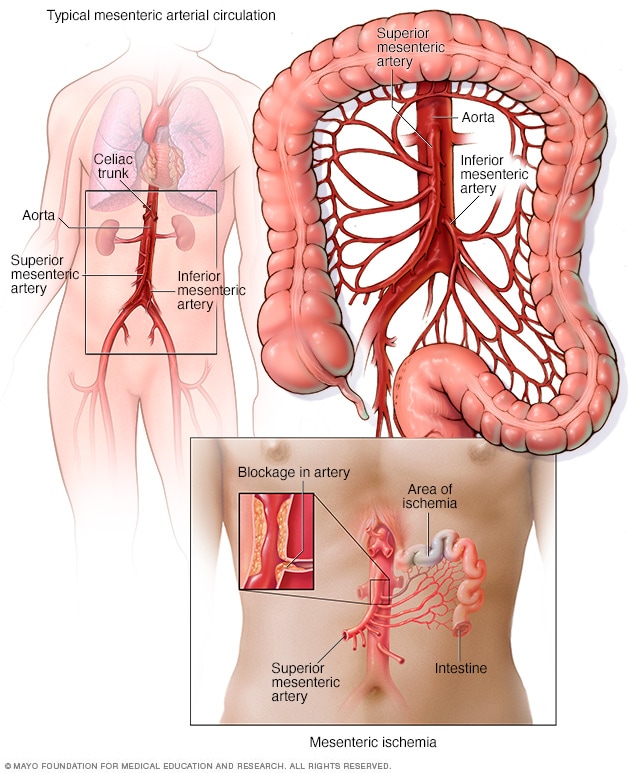 典型肠系膜动脉循环与肠系膜缺血