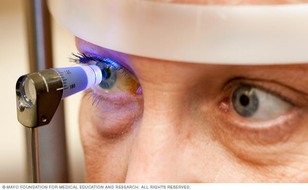 一名患者在妙佑医疗国际青光眼专科组接受眼科检查。
