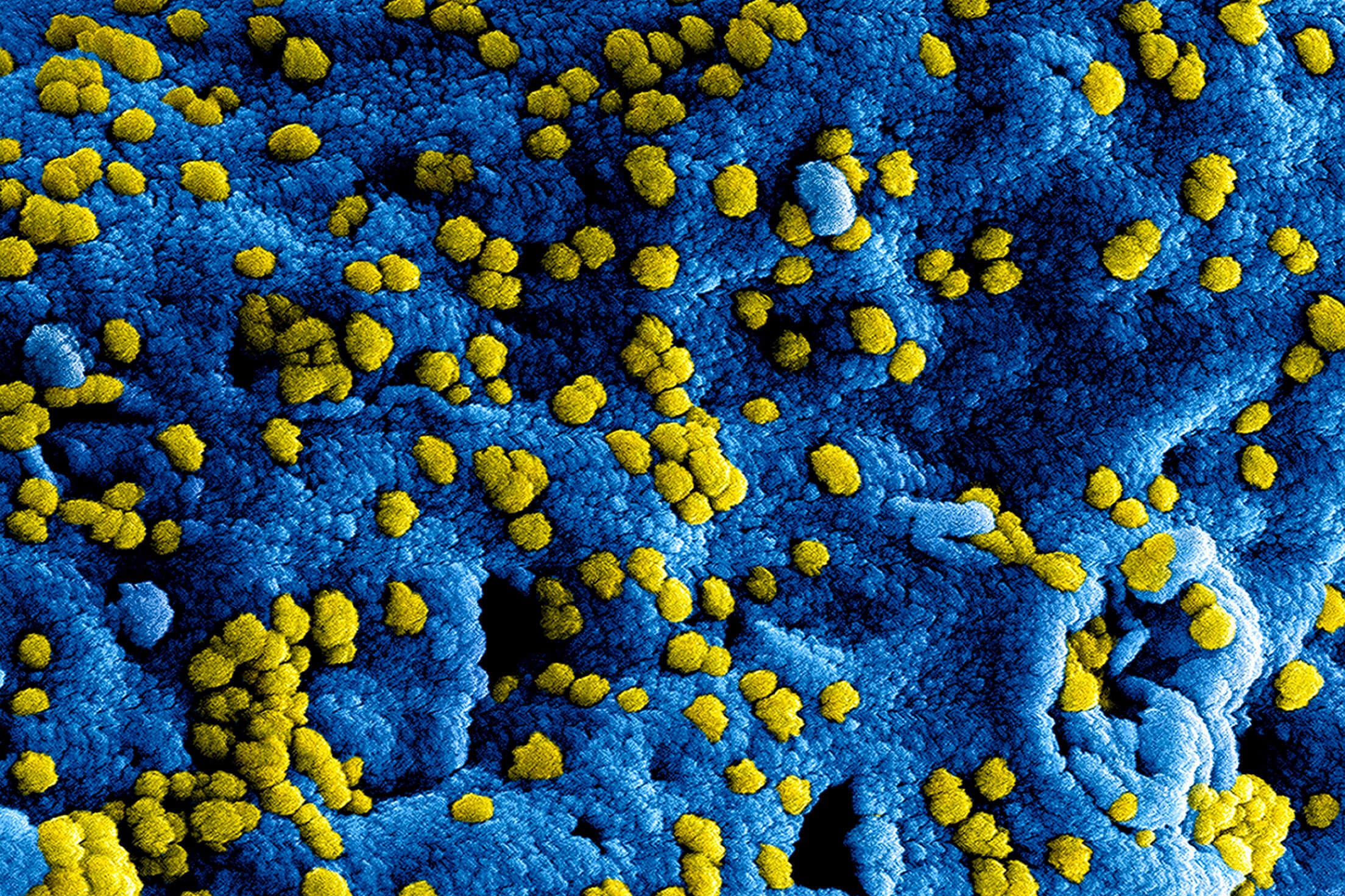 فيروس المتلازمة التنفسية الحادة الوخيمة كورونا (SARS-CoV)